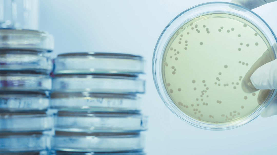 Legionella on a plate bacteria Validate Consulting