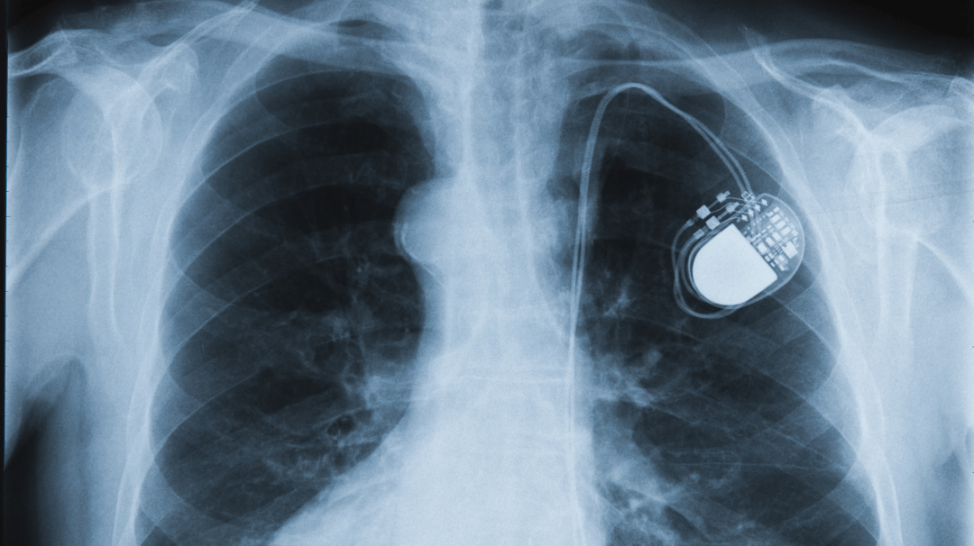 Pacemaker xray Validate Consulting